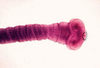 a Tapeworm